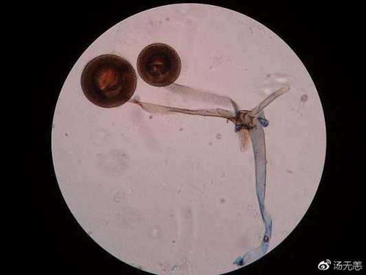 真菌孢子和真菌菌丝怎么产生的？真菌是孢子植物-图3