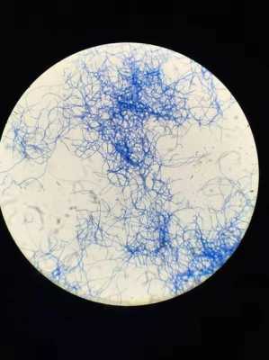 链霉菌有哪些特点？植物病原细菌特点及形状